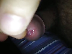 Paroxysmal