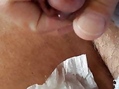 Paroxysmal plus cum