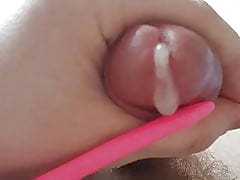 Urethral operation cum