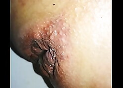 detached anal cum creampie rubberneck pain in the neck